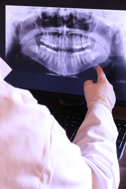 Best Emergency Root Canal Treatment in Fishers, IN
